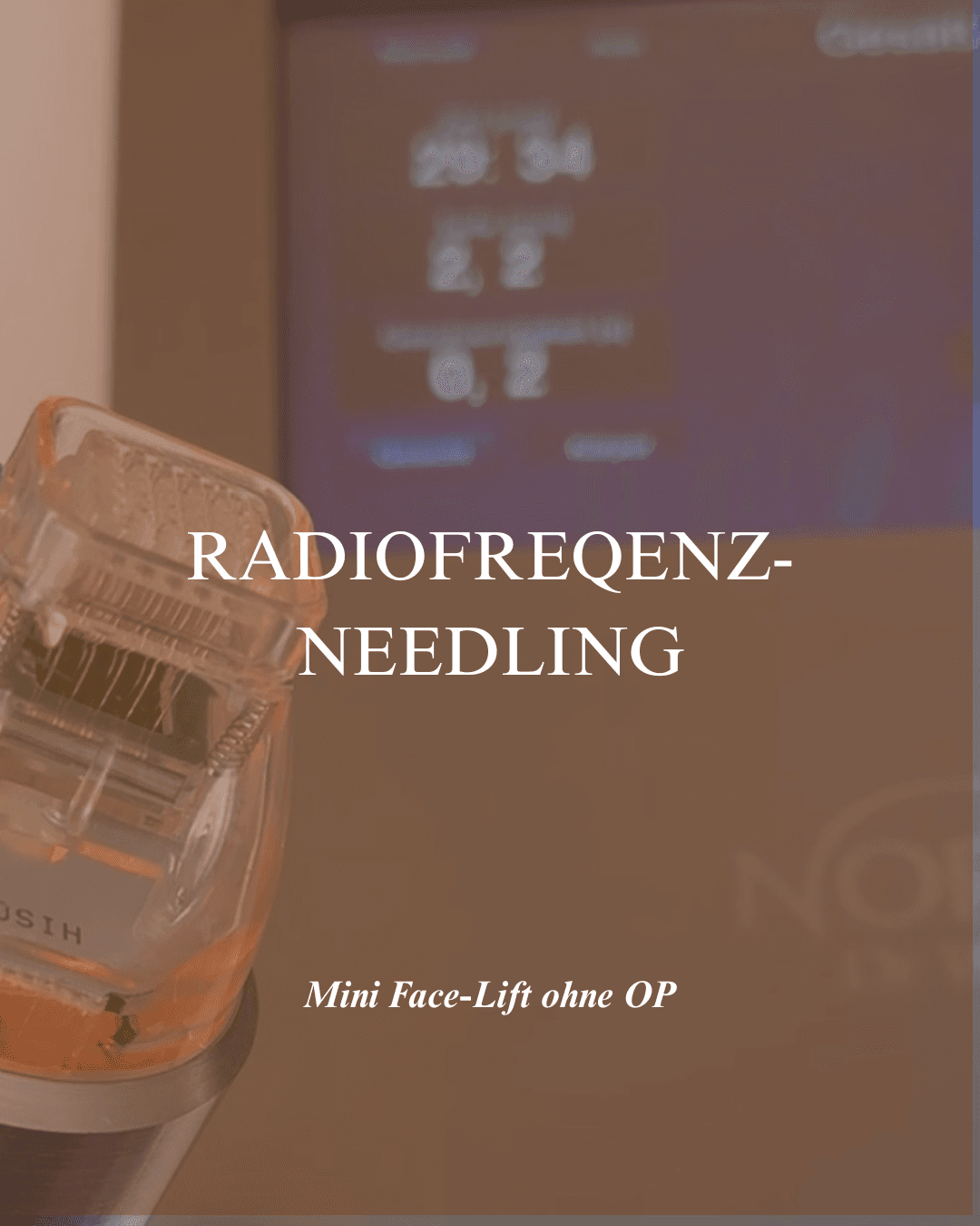 Radiofrequenz-Needling Behandlung